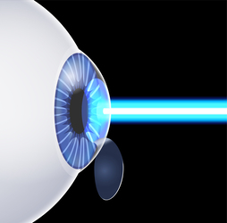 Efekt halo po zabiegu laserowej korekcji wzroku Laserowa korekcja wzroku
