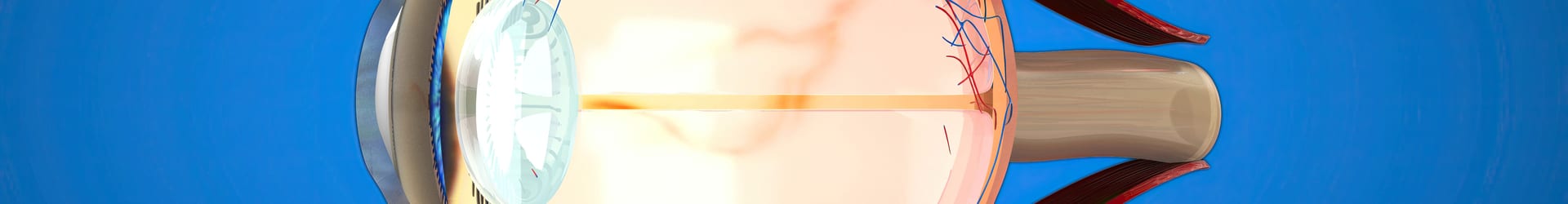 Intro Image